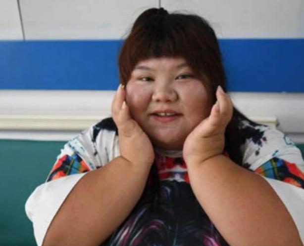 “School Flower“ Chen Wanzhi: 1.55 meters high and weighing more than 300 kilograms, sleeping on 2 beds, how are the couples now?