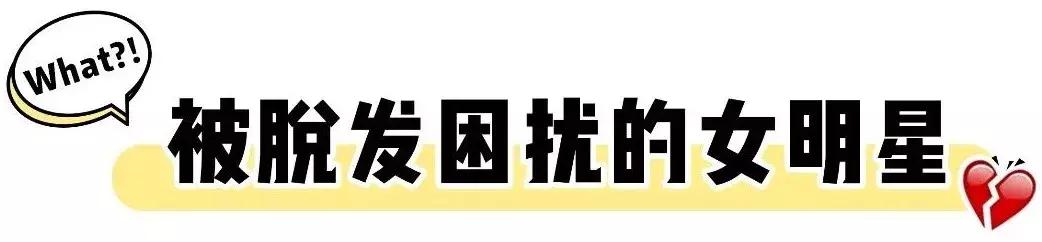 梦见自己掉头发(梦见自己掉头发一抓一大把是什么意思)插图3