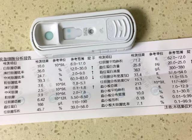 辟謠：狗狗吃豬肉可以變胖？給它們吃豬肉會對身體造成很大傷害 萌趣萌寵 第7张