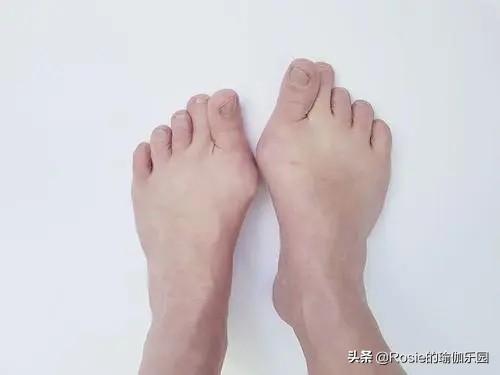 腿精唐嫣美人魚造型太驚艷，如何改善O腿變細直？4個動作帶你練 健身減肥達人 第16张