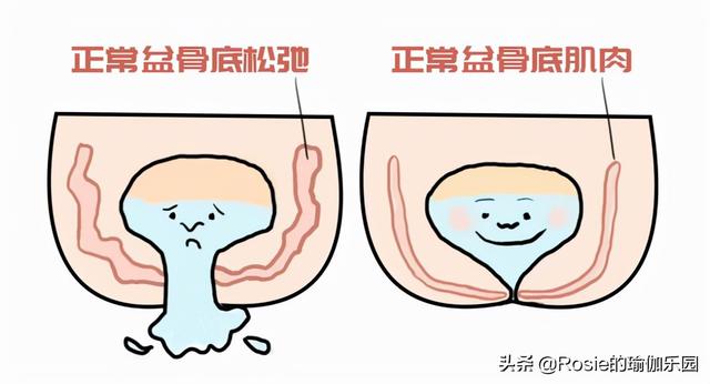 38歲備孕3年，林依晨順利產女，產後盆底肌鬆弛、漏尿如何做？ 健身減肥達人 第15张