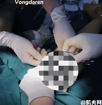 網紅式審美被噴上熱搜：這是自殘，不是性感 街拍正妹 第3张