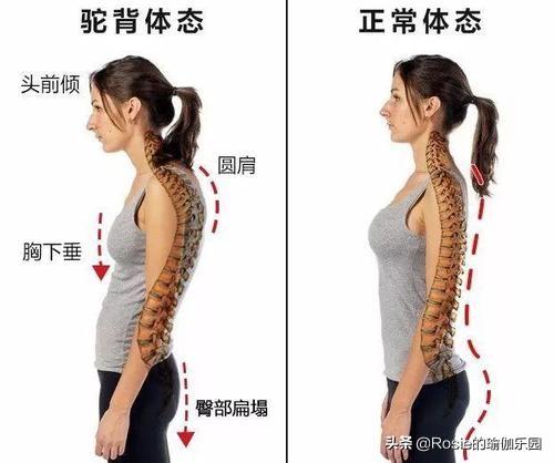 彎腰駝背胸縮水，辦公居家三步高效練，調整體態重塑傲人身姿 健身減肥達人 第3张