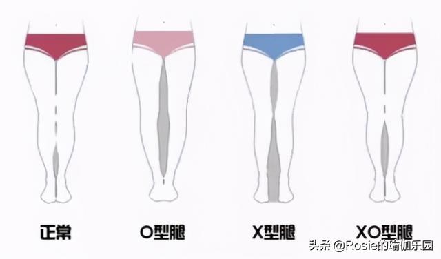 楊冪、江疏影腿精pk選誰？蘿卜腿如何變美腿？2步正腿1次見效 健身減肥達人 第14张