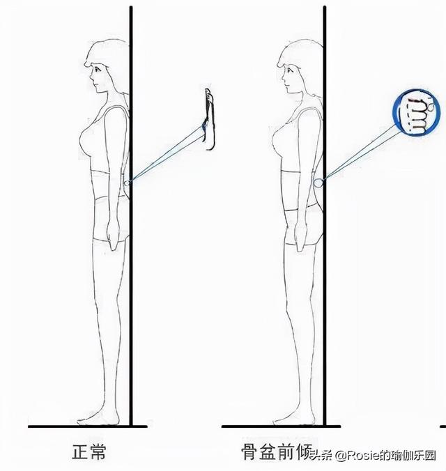 朱珠曬孕照優雅美麗，產後如何擺脫媽媽臀？關注這三點臀翹不腰痛 健身減肥達人 第18张