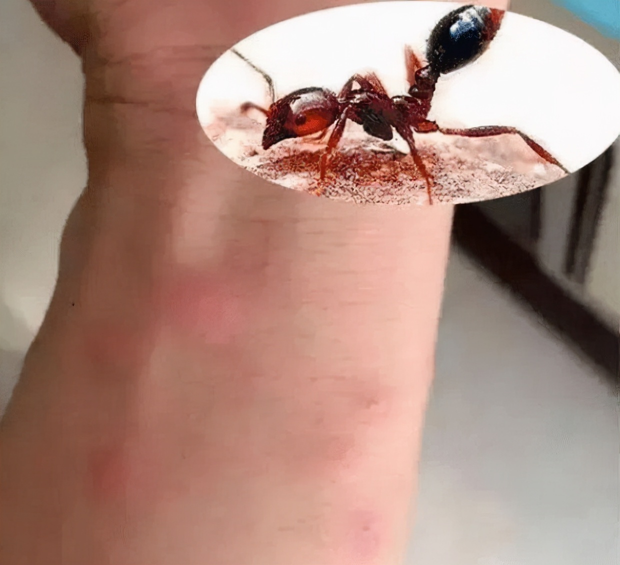 蚂蚁受伤只能等死新研究发现蚂蚁救助医治有“求生欲”的巢友_探秘志
