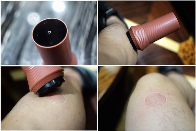 养生利器 左点智能走罐刮痧器