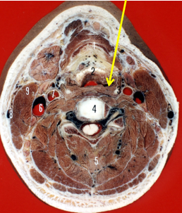 颈部横断面图片