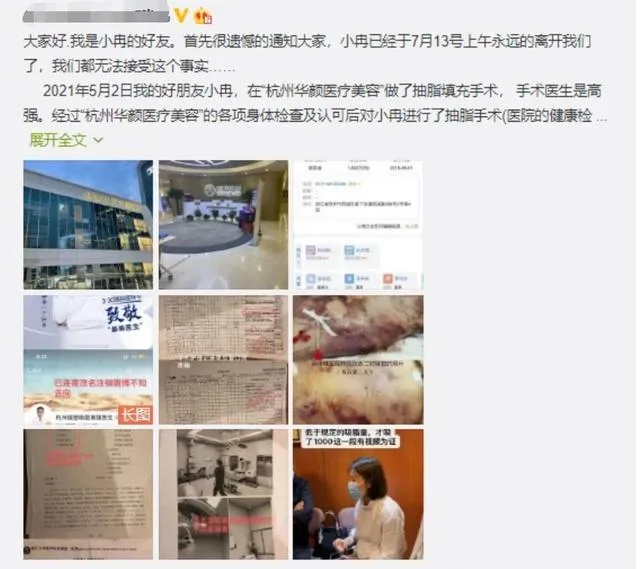 近日，来自我罗斯索契的一女子，整形后表情瘫痪(图3)