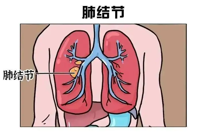 网络