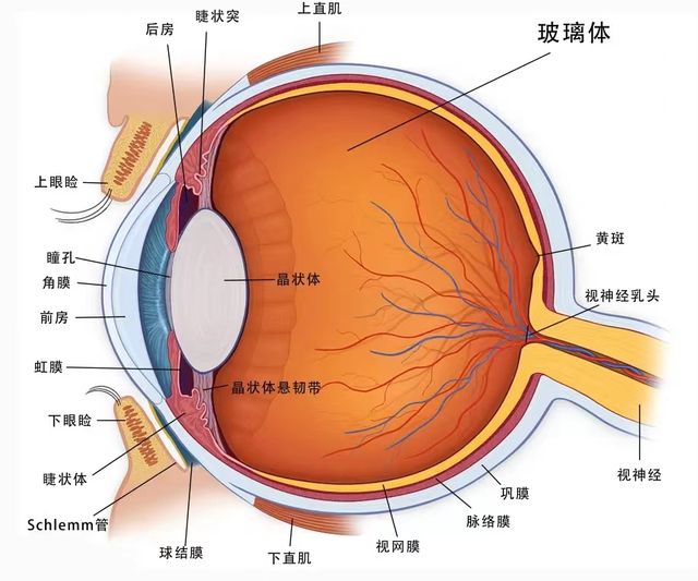 复发性视网膜脱离怎么办？折叠式人工玻璃体球囊保眼球，不复脱