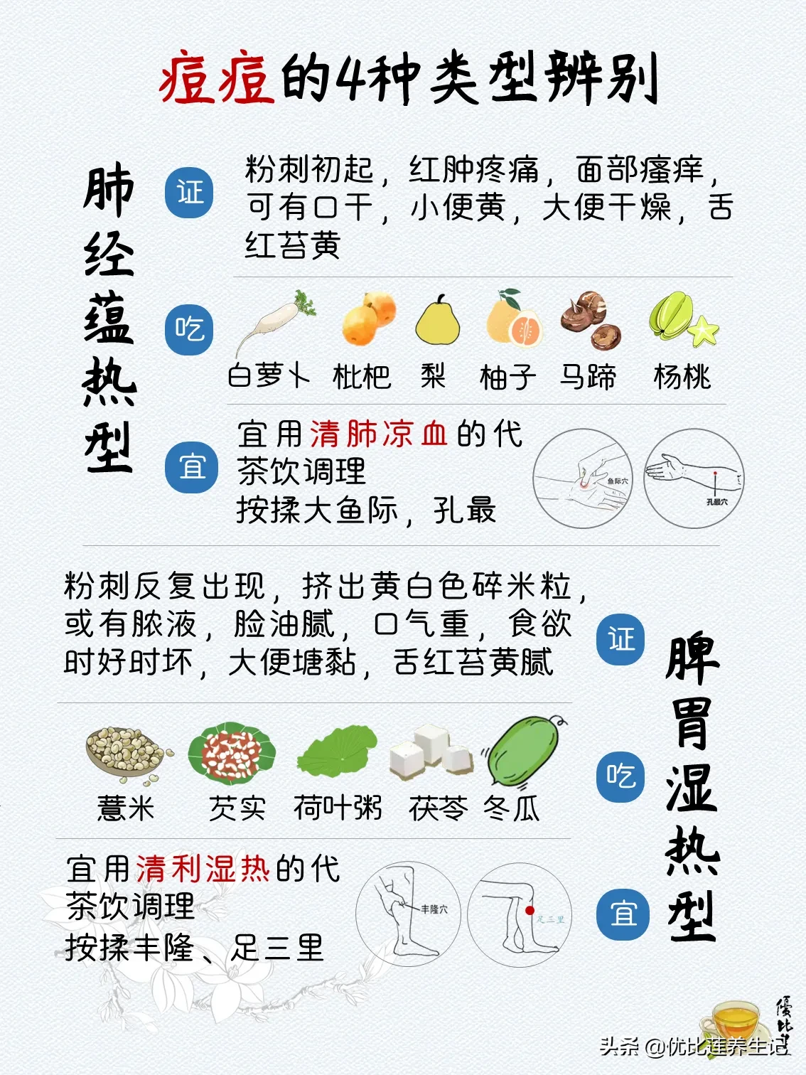 痘痘的4种常见类型辨别 送心 肺经蕴热型证 粉刺初起 红zhong疼痛 面部瘙痒 可有口干 小便黄 大便干燥 舌红苔黄