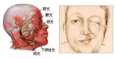 左眼跳是什么预兆,左眼跳小心是这4种疾病