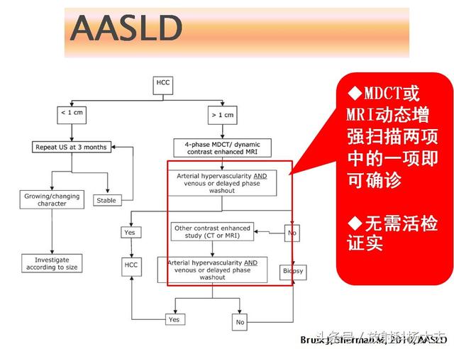 肝脏检查示高分化hcc什么意思