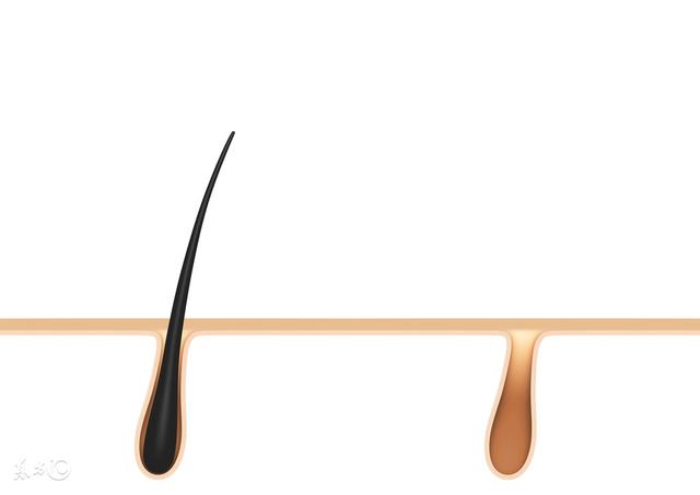 毛囊角化会褪皮吗