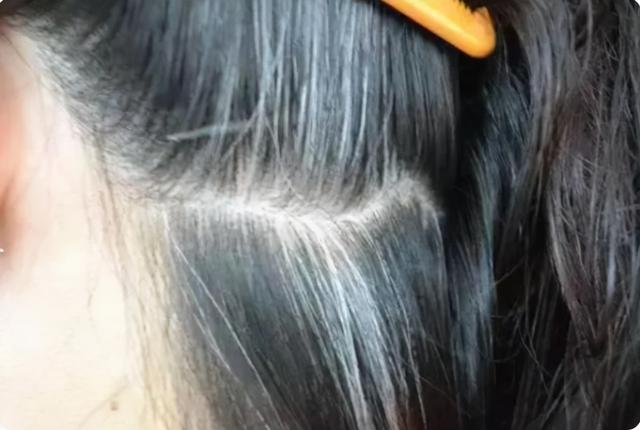 有了白发先别着急染发，多吃这5种食物，或许能改善