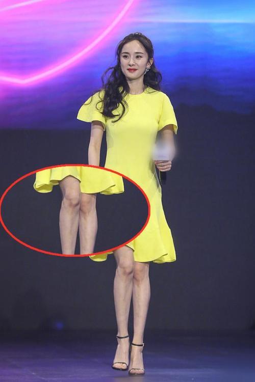 鸡皮肤只有女生有吗