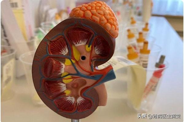 男子肾病吃鱼为啥会加重发生肾衰？肾病这几种食物不宜吃