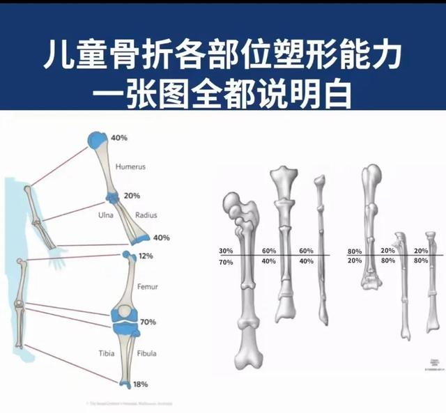 小儿胫骨远端骨折临床总结