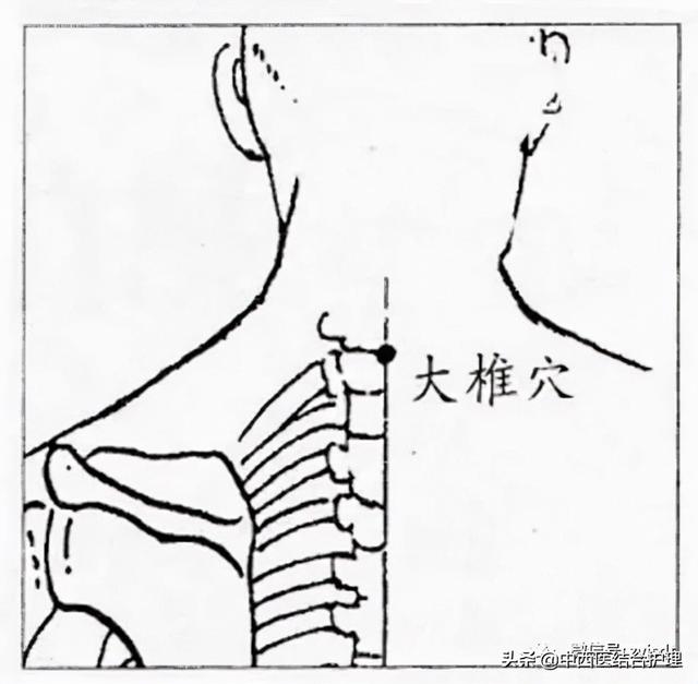 「穴位养生」大椎穴，调病多