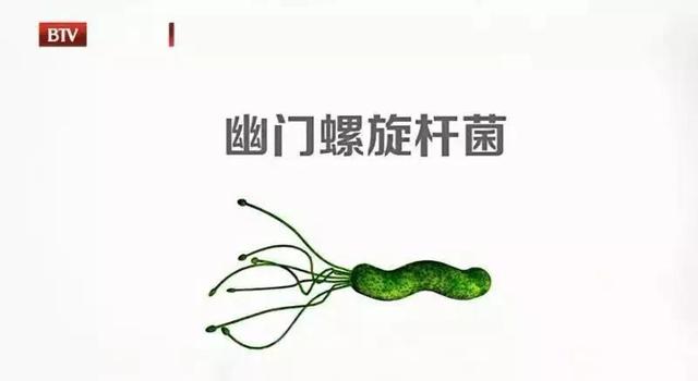 重口胃、细菌胃、弹簧胃，吃出来的“不良胃”，你中招了吗？健康好胃，得这么养