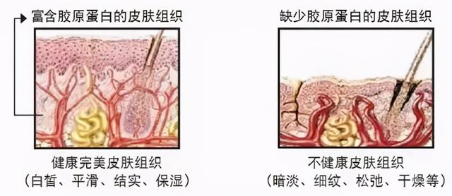 水杨酸引起皮肤角化异常