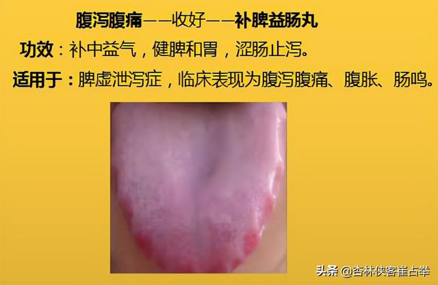 咽炎、高脂血症，四肢麻木，10个中成药，年过35岁后要收藏备好