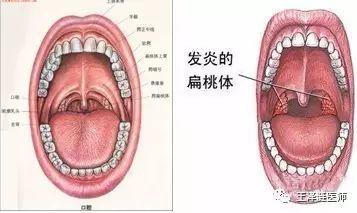 暑假尽量少给宝宝们吃这些东西，容易导致喉咙痛及发烧