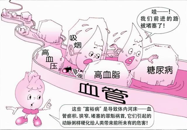 吃“他汀”药降胆固醇，每位患者都是有目标值的