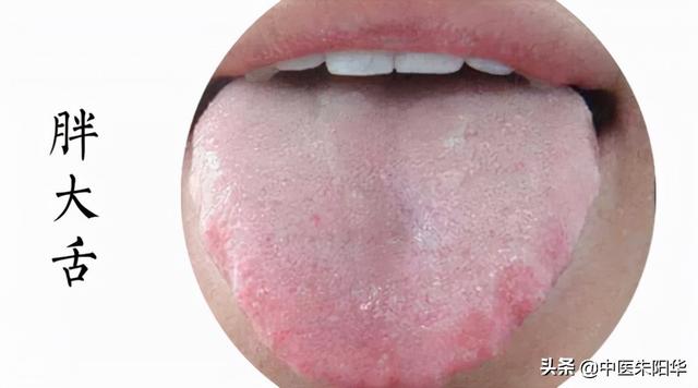 对镜查舌早知病！中医教您如何通过舌头快速识别疾病