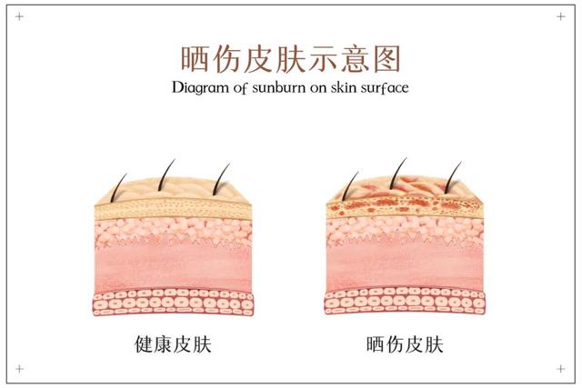 清凉不痒，夏季宝宝这样过｜悠然度夏②