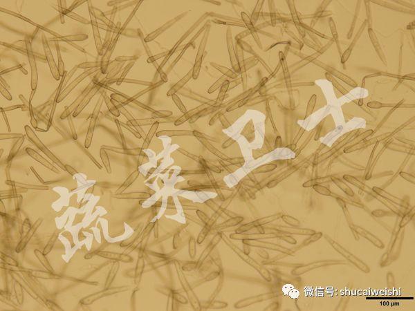 黄瓜“小黄点”蔓延，多措施做好防控9