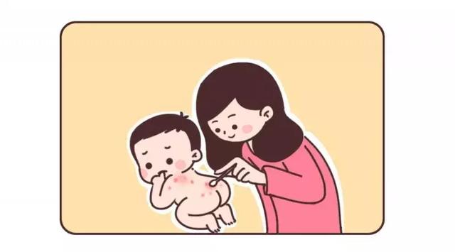 长痱子能涂身体乳吗