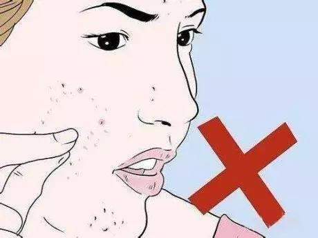 毛囊角化里面挤出来是白色的吗