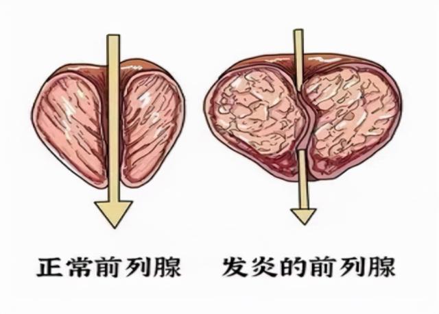 哮喘联盟 昆亮医学