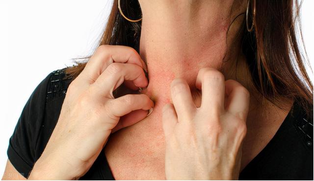 靶向治疗，出现皮疹怎么办？中医辛凉透疹，清热解毒，止痒祛皮疹