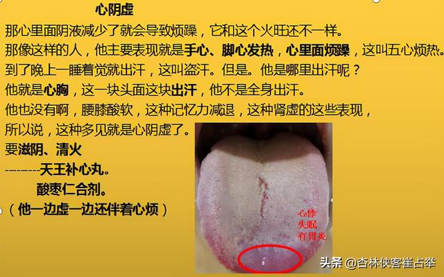 治疗失眠的中成药大总结，失眠、多梦、入睡困难再也不怕用错药