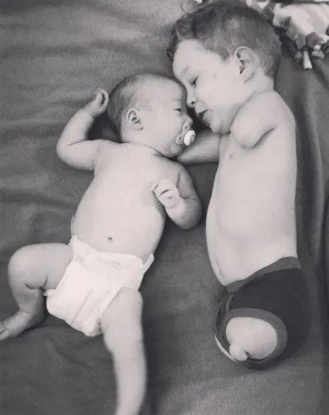 B超婴儿无四肢，18岁妈妈拒绝堕胎，冒险生子，把孩子养成男子汉