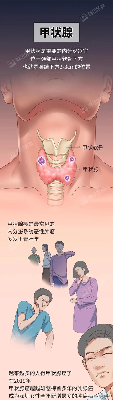 全网，超过50%的“健康”科普不“健康”，这篇防癌科普值得推荐