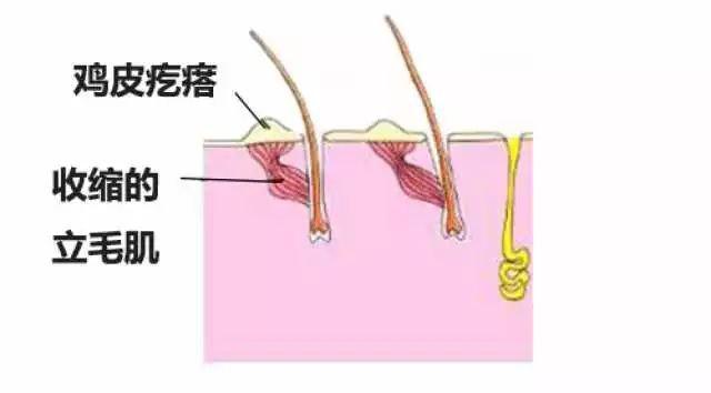 好多鸡皮疙瘩