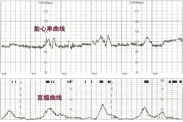 生娃的痛，只有经历过才知道