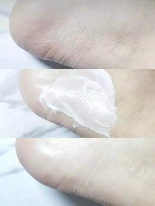 拿身体乳涂在脚上拿塑料包着