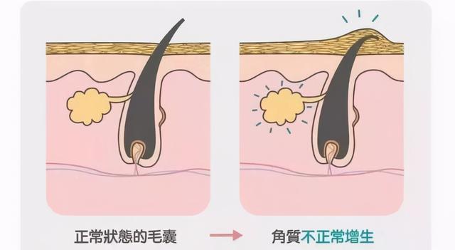 delon身体乳会长毛吗