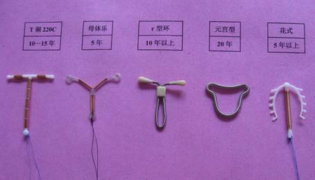 避孕环是什么原理（避孕环、节育环、宫内节育器是个啥）
