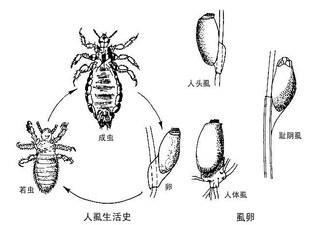 男性身上有阴虱怎么办？4招可快速杀虫，避免传染给伴侣1