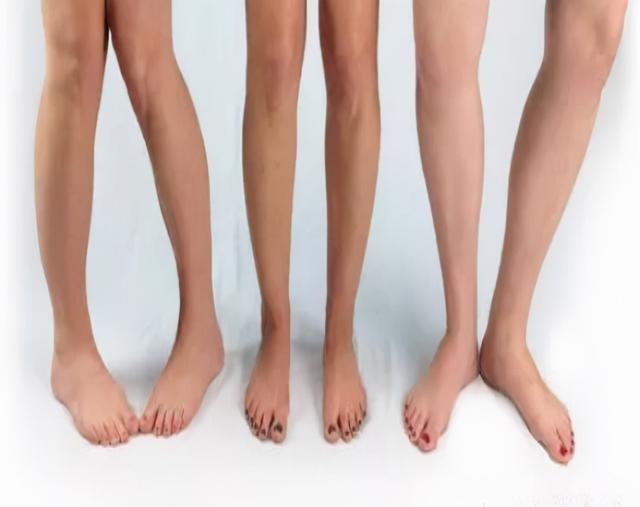 内八字、外八字孩子脚型正常不正常，家长可以这么判断