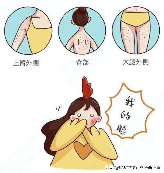 毛周角化运动后全脸通红