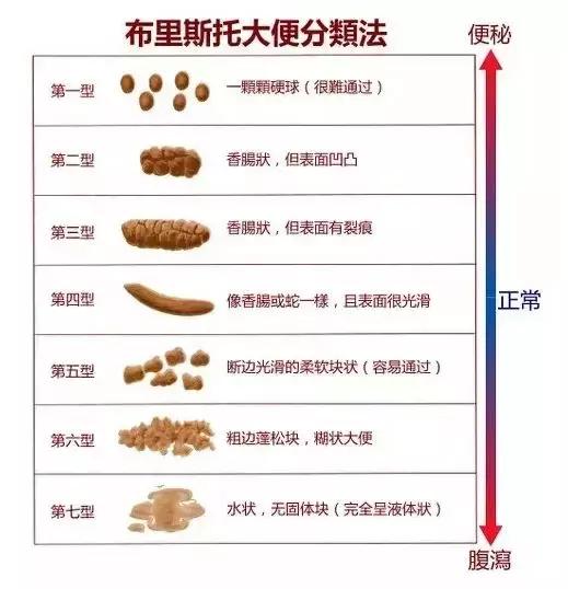 通过便便识宝宝健康，儿科医生来教你 宝宝健康 第3张