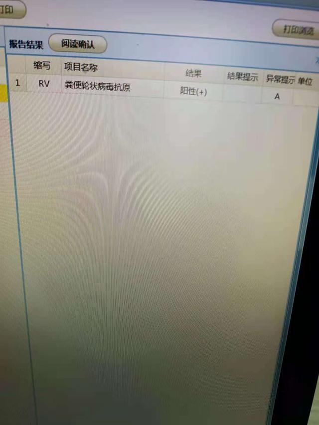 6月婴儿轮状病毒感染后引起腹泻经治疗后康复