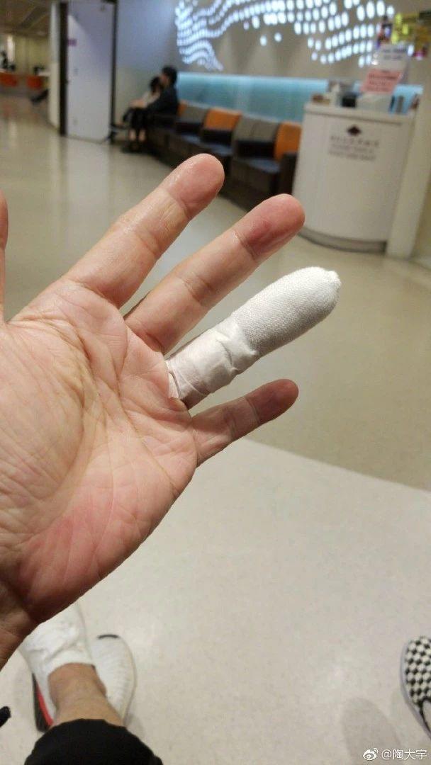 56岁前TVB当家小生晒手指包扎照惹关注：一时失手割伤